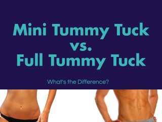 Mini Tummy Tuck vs. Full Tummy Tuck: What's the Difference?