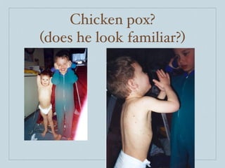 Chicken pox?
(does he look familiar?)
 