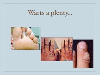 Warts a plenty...
 