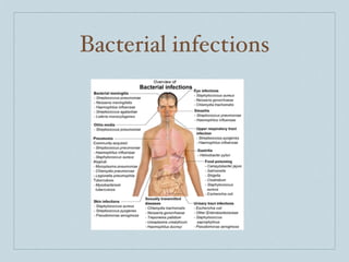 Bacterial infections
 