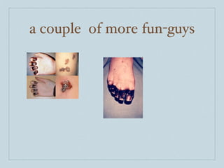 a couple of more fun-guys
 