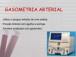 GASOMETRIA ARTERIAL
Utiliza o sangue retirado de uma artéria.
Punção Arterial com agulha e seringa.
Amostra analisada com gasômetro.
 