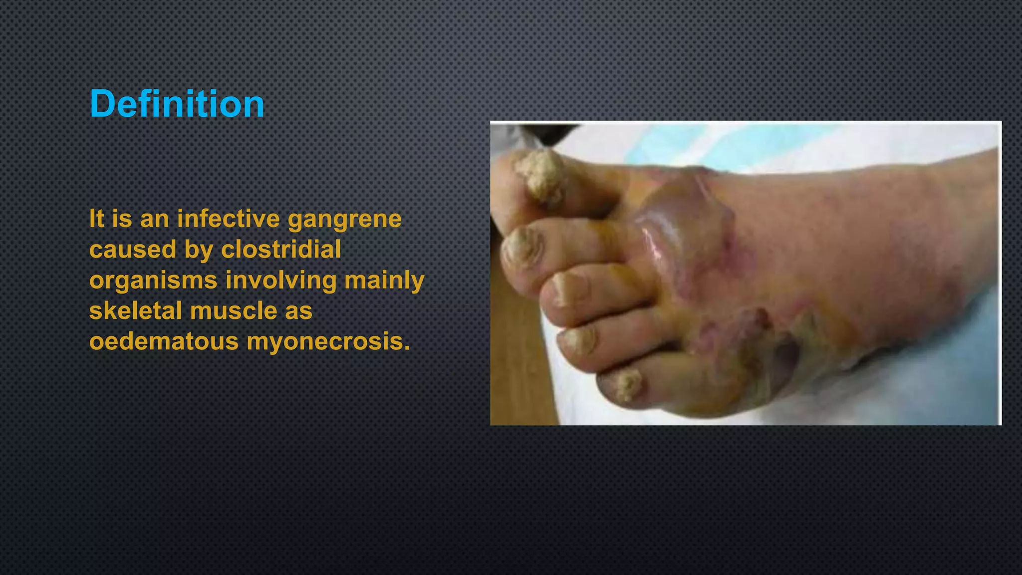Gas gangrene | PPTX, image size:2048x1152