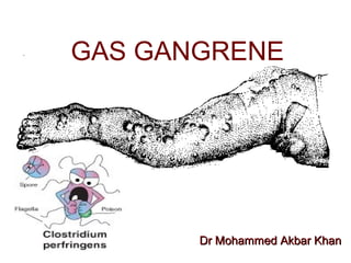 GAS GANGRENE
Dr Mohammed Akbar KhanDr Mohammed Akbar Khan
 