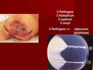 C Perfringens
C histolyticum
C septicum
C novyii
C Perfringens Alpha toxin
(lecithinase)
 