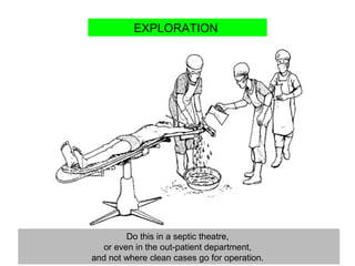 Do this in a septic theatre,
or even in the out-patient department,
and not where clean cases go for operation.
EXPLORATION
 