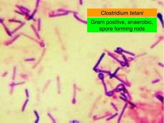 Gram positive, anaerobic,
spore forming rods
Clostridium tetani
 