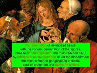 Contamination of devitalized tissue
with the spores, germination of the spores,
release of tetanospasmin, the toxin reaches CNS
by retrograde axonal transport or via the bloodstream
the toxin is fixed to gangliosides in spinal
cord or brainstem and exerts its actions
 