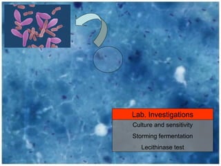 Culture and sensitivity
Storming fermentation
Lecithinase test
Lab. Investigations
 