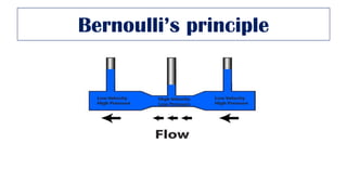 Bernoulli’s principle
 