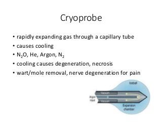 Cryoprobe
• rapidly expanding gas through a capillary tube
• causes cooling
• N2O, He, Argon, N2
• cooling causes degeneration, necrosis
• wart/mole removal, nerve degeneration for pain
 