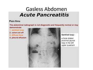 Gasless Abdomen and displaced bowel.pptx