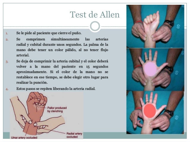 Gasometría arterial