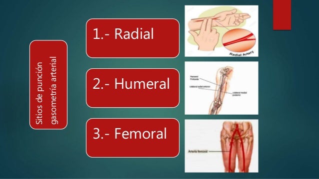 Gasometría arterial y venosa