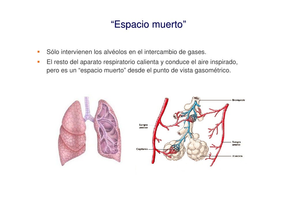 Interpretación de la Gasometría Arterial