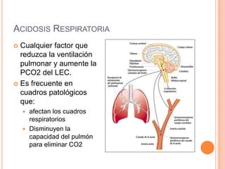 Acidosis Respiratoria<br />Cualquier factor que reduzca la ventilación pulmonar y aumente la PCO2 del LEC.<br />Es frecuen...