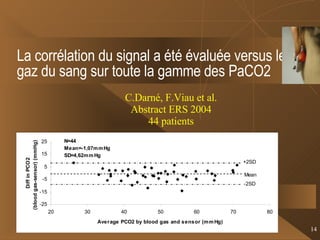 La corrélation du signal a été évaluée versus les gaz du sang sur toute la gamme des PaCO2 C.Darné, F.Viau et al. Abstract ERS 2004 44 patients 