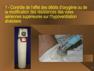 1 - Contrôle de l’effet des débits d’oxygène ou de la modification des résistances des voies aériennes supérieures sur l’hypoventilation alvéolaire 
