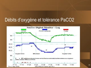 Débits d’oxygène et tolérance PaCO2 