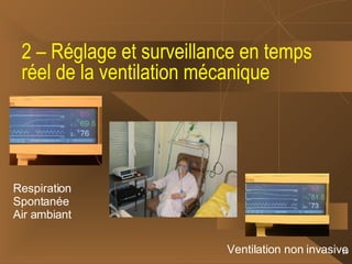2 – Réglage et surveillance en temps réel de la ventilation mécanique Respiration  Spontanée Air ambiant Ventilation non invasive 