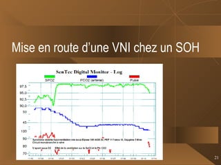 Mise en route d’une VNI chez un SOH 