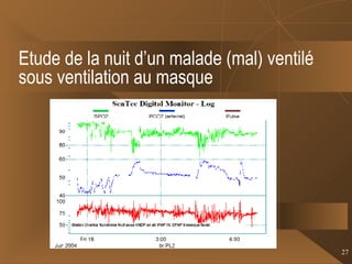 Etude de la nuit d’un malade (mal) ventilé sous ventilation au masque  