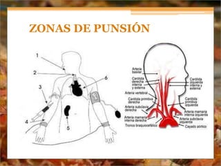 ZONAS DE PUNSIÓN
 