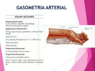 GASOMETRIA ARTERIAL

 