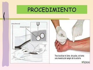 PROCEDIMIENTO
