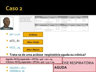  pH = 7.20
 pCO2 = 82
 HCO3
-
= 29
 Trata-se de uma acidose respiratória aguda ou crônica?
 AGUDA = 28.2
 CRÔNICA: 36
Acidose
Alta= Ácido
Alto= Básico
ACIDOSE RESPIRATÓRIA
AGUDA
Aguda: HCO3 esperado = (PCO2 -40) ÷ 10 + 24
Crônica: HCO3 esperado = (PCO2 -40) ÷ 3.5 + 24.
 