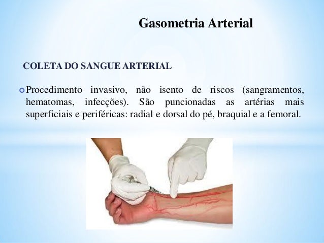 Exame de sangue gasometria arterial