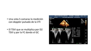 gasto-cardiaco-pptx