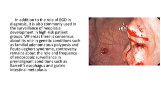 In addition to the role of EGD in
diagnosis, it is also commonly used in
the surveillance of neoplasia
development in high-risk patient
groups. Whereas there is consensus
about its role in genetic conditions such
as familial adenomatous polyposis and
Peutz–Jeghers syndrome, controversy
remains about the role and frequency
of endoscopic surveillance in
premalignant conditions such as
Barrett’s esophagus and gastric
intestinal metaplasia
 