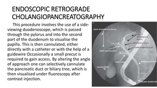 ENDOSCOPIC RETROGRADE
CHOLANGIOPANCREATOGRAPHY
This procedure involves the use of a side-
viewing duodenoscope, which is passed
through the pylorus and into the second
part of the duodenum to visualise the
papilla. This is then cannulated, either
directly with a catheter or with the help of a
guidewire Occasionally a small precut is
required to gain access. By altering the angle
of approach one can selectively cannulate
the pancreatic duct or biliary tree, which is
then visualised under fluoroscopy after
contrast injection.
 