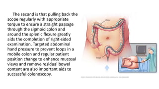 The second is that pulling back the
scope regularly with appropriate
torque to ensure a straight passage
through the sigmoid colon and
around the splenic flexure greatly
aids the completion of right-sided
examination. Targeted abdominal
hand pressure to prevent loops in a
mobile colon and regular patient
position change to enhance mucosal
views and remove residual bowel
content are also important aids to
successful colonoscopy.
 