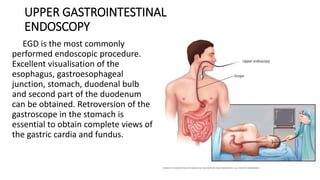 UPPER GASTROINTESTINAL
ENDOSCOPY
EGD is the most commonly
performed endoscopic procedure.
Excellent visualisation of the
esophagus, gastroesophageal
junction, stomach, duodenal bulb
and second part of the duodenum
can be obtained. Retroversion of the
gastroscope in the stomach is
essential to obtain complete views of
the gastric cardia and fundus.
 