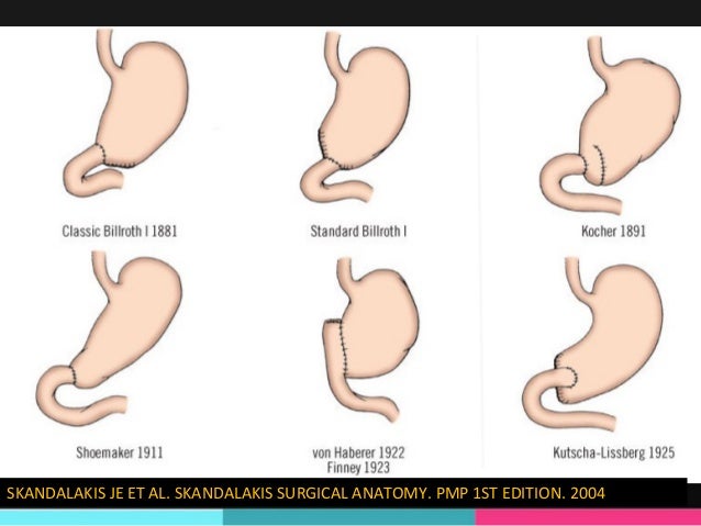 Surgery Of The Alimentary Tract