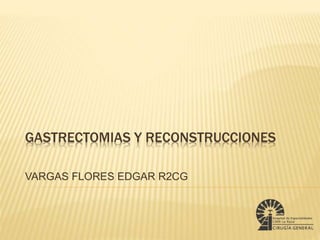 GASTRECTOMIAS Y RECONSTRUCCIONES 
VARGAS FLORES EDGAR R2CG 
 