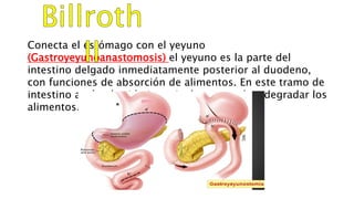 Conecta el estómago con el yeyuno
(Gastroyeyunoanastomosis) el yeyuno es la parte del
intestino delgado inmediatamente posterior al duodeno,
con funciones de absorción de alimentos. En este tramo de
intestino actúa el acido intestinal, que ayuda a degradar los
alimentos.
 