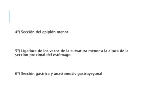 4º) Sección del epiplón menor.
5º) Ligadura de los vasos de la curvatura menor a la altura de la
sección proximal del estómago.
6º) Sección gástrica y anastomosis gastroyeyunal
 