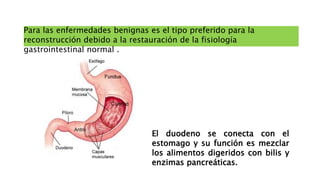 Para las enfermedades benignas es el tipo preferido para la
reconstrucción debido a la restauración de la fisiología
gastrointestinal normal .
 