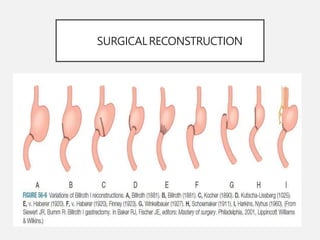 SURGICALRECONSTRUCTION
 