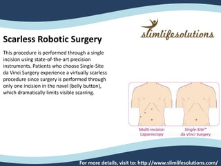 For more details, visit to: http://www.slimlifesolutions.com/
Scarless Robotic Surgery
This procedure is performed through a single
incision using state-of-the-art precision
instruments. Patients who choose Single-Site
da Vinci Surgery experience a virtually scarless
procedure since surgery is performed through
only one incision in the navel (belly button),
which dramatically limits visible scarring.
 