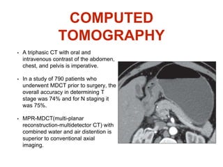 COMPUTED
TOMOGRAPHY
• A triphasic CT with oral and
intravenous contrast of the abdomen,
chest, and pelvis is imperative.
• In a study of 790 patients who
underwent MDCT prior to surgery, the
overall accuracy in determining T
stage was 74% and for N staging it
was 75%.
• MPR-MDCT(multi-planar
reconstruction-multidetector CT) with
combined water and air distention is
superior to conventional axial
imaging.
 