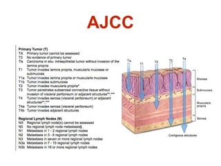 AJCC
 