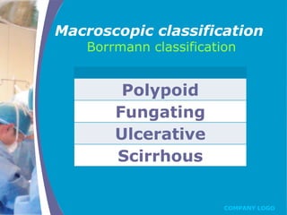 Boreman Classification Gastric cancer | PPTX