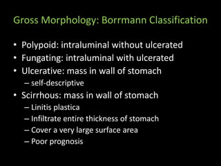 Boreman Classification Gastric cancer | PPTX