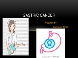 Prepared by
Mehwish Jamil
GASTRIC CANCER
 