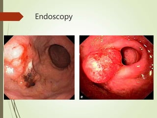Endoscopy
 