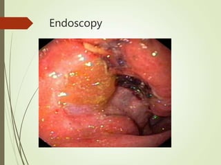 Endoscopy
 
